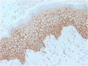 Immunohistochemical analysis of formalin-fixed, paraffin-embedded human skin using Anti-E Cadherin Antibody [SPM471]