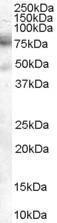 Anti-DCP1A Antibody (A84179) (2 µg/ml) staining of A431 cell lysate (35 µg protein in RIPA buffer). Primary incubation was 1 hour. Detected by chemiluminescence