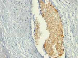 Immunohistochemical analysis of formalin-fixed, paraffin-embedded human placenta using Anti-AMPD3 Antibody [AMPD3/901]