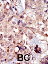 Anti-MYLK Rabbit Polyclonal Antibody