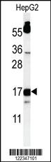 Anti-TYROBP Rabbit Polyclonal Antibody