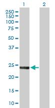 Anti-SNAP23 Rabbit Polyclonal Antibody