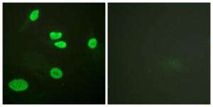 Immunofluorescence analysis of HeLa cells using Anti-Histone H3 (acetyl Lys9) Antibody. The right hand panel represents a negative control, where the antibody was pre-incubated with the immunising peptide.