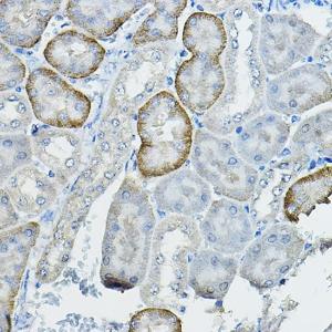 Immunohistochemistry analysis of paraffin-embedded mouse kidney using Anti-Fhip2b Antibody (A305973) at a dilution of 1:100 (40x lens). Perform high pressure antigen retrieval with 10 mM citrate buffer pH 6.0 before commencing with IHC staining protocol.