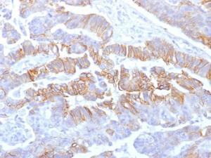 Anti-E Cadherin Mouse Recombinant Antibody [clone: rCDH1/1525]