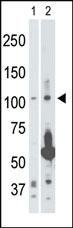 Anti-MAP3K14 Rabbit Polyclonal Antibody