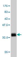 Anti-USP31 Mouse Monoclonal Antibody [clone: 3B6]