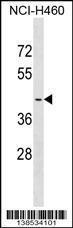 Anti-OR2A4 Rabbit Polyclonal Antibody (AP (Alkaline Phosphatase))