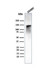 Western blot analysis of human ovary tissue lysate using Anti-Caldesmon Antibody [CALD1/1424R]