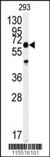 Anti-PROX1 Rabbit Polyclonal Antibody