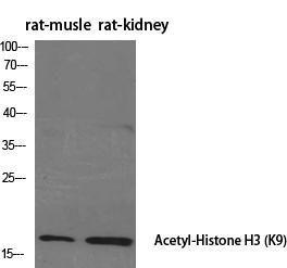 Western blot analysis of various cells using Anti-Histone H3 (acetyl Lys9) Antibody