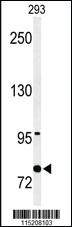 Anti-PROX-1-S514 Rabbit Polyclonal Antibody