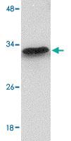 Anti-MTCH2 Rabbit Polyclonal Antibody