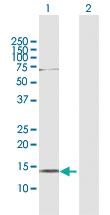 Anti-AKAP7 Rabbit Polyclonal Antibody