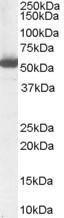 Anti-ALDH1A1 antibody