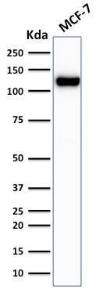 Anti-E Cadherin Mouse Recombinant Antibody [clone: rCDH1/1525]