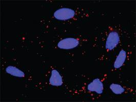 Anti-SYK Antibody Pair