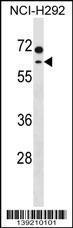 Anti-MCCC2 Rabbit Polyclonal Antibody (PE (Phycoerythrin))