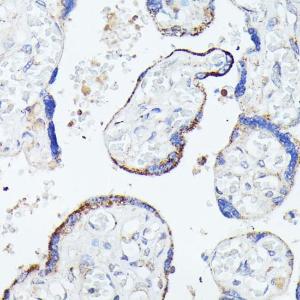 Immunohistochemistry analysis of paraffin-embedded human placenta using Anti-C1orf41 Antibody (A307693) at a dilution of 1:100 (40x lens). Perform microwave antigen retrieval with 10 mM PBS buffer pH 7.2 before commencing with IHC staining protocol