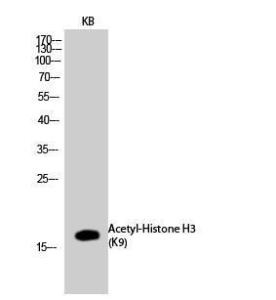 Western blot analysis of KB cells using Anti-Histone H3 (acetyl Lys9) Antibody