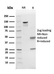 SDS-PAGE analysis of Anti-GCLM Antibody [CPTC-GCLM-1] under non-reduced and reduced conditions; showing intact IgG and intact heavy and light chains, respectively. SDS-PAGE analysis confirms the integrity and purity of the antibody.