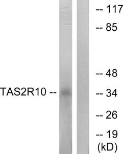 Antibody anti-TAS2R10 A99254-100 100 µg