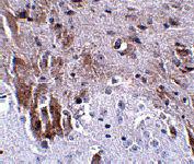 Anti-LRFN1 Rabbit Polyclonal Antibody