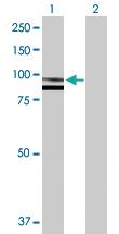 Anti-SPG7 Rabbit Polyclonal Antibody