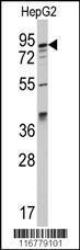 Anti-AAK1 Rabbit Polyclonal Antibody