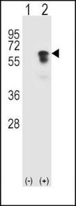 Anti-ACVR1 Rabbit Polyclonal Antibody (APC (Allophycocyanin))