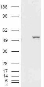 Anti-ALDH1A1 antibody