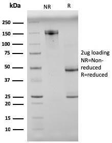 Anti-N Cadherin Mouse Monoclonal Antibody [clone: 8C11]