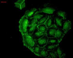 Immunocytochemistry/Immunofluorescence analysis of human HaCaT cells, fixed in cold 100% methanol for 10 minutes at -20°C, using Anti-Heme Oxygenase 1 Antibody [1F12-A6] (A304771), at 1:100 for 1 hour at room temperature