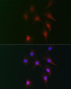 Immunofluorescence analysis of NIH-3T3 cells using Anti-Fhip2b Antibody (A305973) at a dilution of 1:100 (40x lens). DAPI was used to stain the cell nuclei (blue).