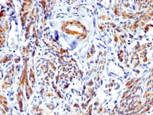 Immunohistochemical analysis of formalin-fixed, paraffin-embedded human uterus using Anti-Caldesmon Antibody