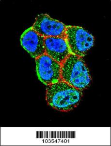 Anti-STK11 Rabbit Polyclonal Antibody (HRP (Horseradish Peroxidase))