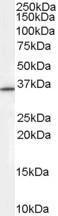 Anti-RNF115 Antibody (A84185) (0.3 µg/ml) staining of HEPG2 cell lysate (35 µg protein in RIPA buffer). Primary incubation was 1 hour. Detected by chemilu minescence