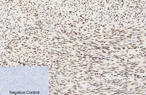 Immunohistochemical analysis of paraffin-embedded human uterus tissue using Anti-Histone H3 (acetyl Lys9) Antibody at 1:200 (4°C overnight). Negative control was secondary antibody only.