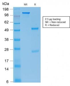 Anti-E Cadherin Mouse Recombinant Antibody [clone: rCDH1/1525]