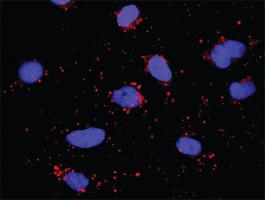 Anti-CD74 + HLA-DQA1 Antibody Pair