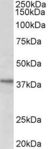 Anti-C12orf29 Antibody (A82663) (1µg/ml) staining of HeLa lysate (35µg protein in RIPA buffer). Primary incubation was 1 hour. Detected by chemiluminescence.