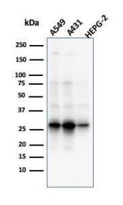 Western blot analysis of A549, A431, and HepG2 cell lysates using Anti-GCLM Antibody [CPTC-GCLM-1]