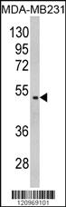 Anti-GALT Rabbit Polyclonal Antibody