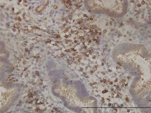 Anti-PANK2 Mouse Monoclonal Antibody [clone: 2B12]