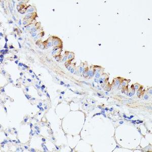 Immunohistochemistry analysis of paraffin-embedded mouse lung using Anti-C1orf41 Antibody (A307693) at a dilution of 1:100 (40x lens). Perform microwave antigen retrieval with 10 mM PBS buffer pH 7.2 before commencing with IHC staining protocol