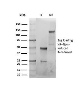 SDS-PAGE analysis of Anti-CFTR Antibody [CFTR/6477R] under non-reduced and reduced conditions; showing intact IgG and intact heavy and light chains, respectively SDS-PAGE analysis confirms the integrity and purity of the antibody