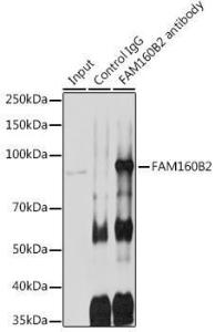 Immunoprecipitation analysis of 600µg extracts of rat testis cells using 3µg of Anti-Fhip2b Antibody (A305973). This Western blot was performed on the immunoprecipitate using Anti-Fhip2b Antibody (A305973) at a dilution of 1:1000.