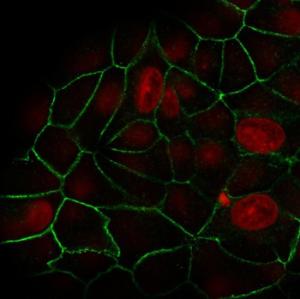 Anti-E Cadherin Mouse Recombinant Antibody [clone: rCDH1/1525]