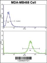 Anti-GALT Rabbit Polyclonal Antibody