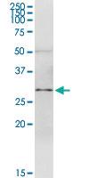 Anti-SPI1 Rabbit Polyclonal Antibody